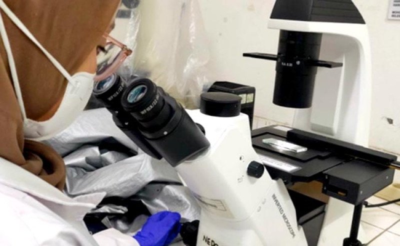 Mahasiswa UGM Kembangkan Superfood Mikroalga untuk Cegah Stunting